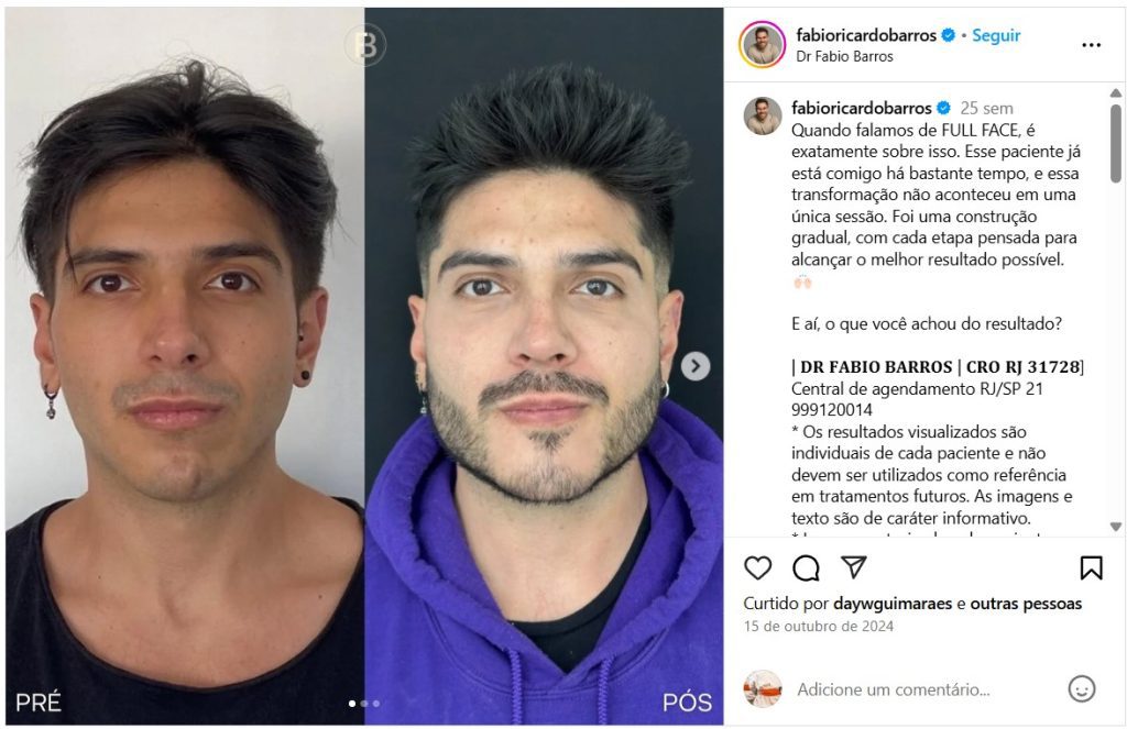 Dr. Fabio Ricardo Barros - Instagram Os Maiores Experts da Harmonização Facial
