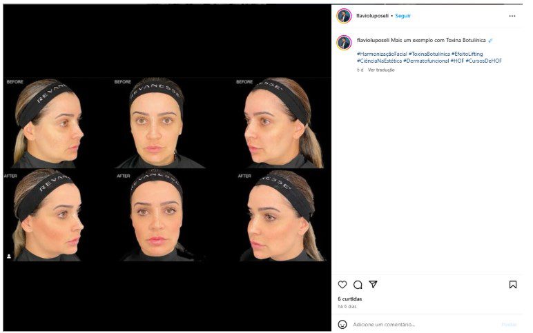 Dr. Flavio Luposeli - Instagram