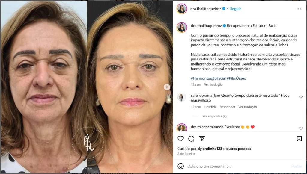 Dra. Thallita Pereira Queiroz - instagram