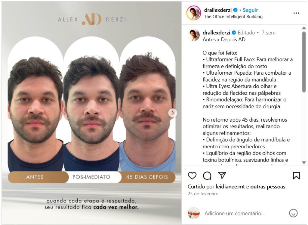 Dr. Alex Derzi - instagram