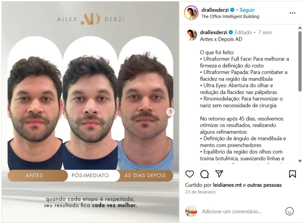 Dr. Alex Derzi - instagram